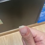 [꼭조언부탁] 네일샵 <b>치료비</b> 청구해보신분 계신가요?