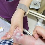 [댓글부탁해] 대학<b>병원</b>에서 테이핑 뜯다 살점 나간거 어떻게 해야되요...