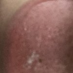 나 혀 데였는데 하얗게 됐어ㅠㅠㅠㅆㅂ 뭐냐