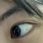 나 쌍수 <b>티</b> 1도 안<b>남</b>