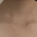 나 <b>승모근</b> 많이 심하지
