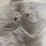 [댓글부탁해] <b>모기</b> 원래 피 이정도 먹음??