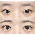 [댓글부탁해] 시선 성형<b>외과</b> ㄱㅊ음???
