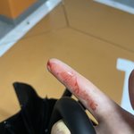 손가락에 피 철철나더니