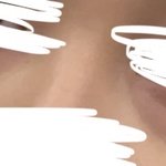 나 다크<b>서클</b> ㅈㄴ 심하지않음???