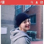 이런 성형보정??이런건 어<b>캐</b>하는거임...??