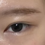 쌍수 <b>절개</b> 2년차