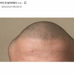 사람 <b>두상</b>이 어케 이렇게 생김