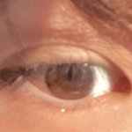 나 쌍커풀 <b>개진</b>함