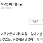 <b>스카</b>빌런이 오늘은 방구뀜