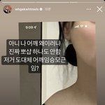 [댓글부탁해] <b>조두</b>팔 승모근 ㅈㄴ 신기하네