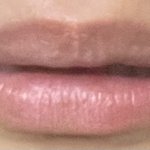 나 ㄹㅇ 병…❤️진같은 습관 있음(약혐..<b>일수도</b>;)