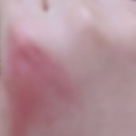 아니 <b>산책</b> 갔다가 모기 물렸는데;;;