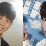 빅<b>히트</b> 코성형 맛집