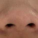 이렇게 생긴 <b>코도</b> 크면서 예뻐질수 있는거야?