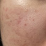 [드루와] 약혐)피부 좋아지는 방법 알려줄게