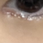 [드루와] 얘들아 이거 흉? 상처? 시간 지나면 <b>사라</b>질까