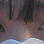 [댓글부탁해] 쌍수 고민 (사진 있음)