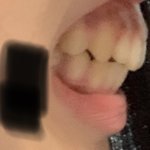 [댓글부탁해] 나 <b>돌출</b>입인데 좀 봐주라