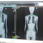 나 변한거 인증할게 엑스레이..