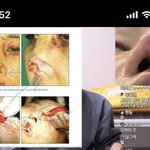 [드루와] 혐오주의)<b>강학</b>두 라이브중인데 이거봐