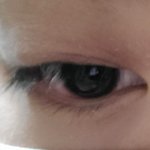 다래끼났어ㅠㅅㅠ
