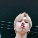 [NCT드림] 어케 코가 <b>이럼</b>?