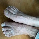 [댓글부탁해] <b>무좀</b> 걸린 남친이 맨발로 제 슬리퍼를 신어서 싸웠습니다