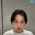 [스키즈] 주근깨 대<b>방출</b>