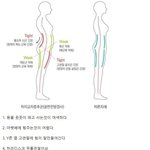 코어 근육이 무너진 사람의 특징