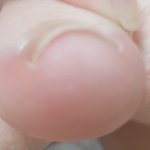 [댓글부탁해] 이거 <b>내성</b>발톱이야????