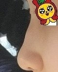 코성형 <b>전후</b>