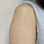 [댓글부탁해] <b>팔뚝</b>살 이거 어케 빼..??