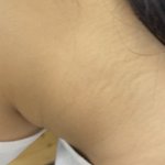 목에 이런거 있는 애들아