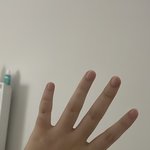 [댓글부탁해] 살 20<b>키</b>로 빼고 손 얼마나 변하는지 찍어<b>봄</b>