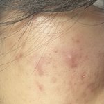 [드루와] 나같은 피부 있냐 ㅠㅠㅠ