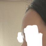 나 무슨 보톡스 맞은 것처럼 생기지 않았냐