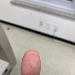 내 쩍쩍 갈라진 <b>지문</b> 볼 사람