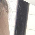 <b>이마</b> 이런건 어케해야함