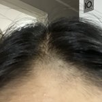 [이것좀봐줘] _ 됨 나 머리 없어짐