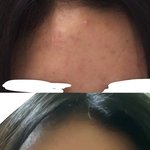 나도 살빼고 피부 확좋아짐