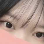 [댓글부탁해] 쌍수 재수술이나 앞트임 <b>복원</b>했던 사람 있어?