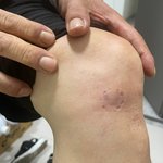 천안 개<b>물림</b>을 이용하여 사기치면서 합의금 받아내는 인간 본적있어요...