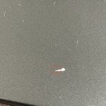 [댓글부탁해] 이것도 <b>내성</b>발톱임??