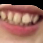 아 나 <b>치열</b> 에바야 진짜
