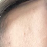 나 피부 ㅈㄴ<b>뒤집</b>힘 어카냐