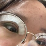 [댓글부탁해] 오늘 <b>쌍수</b>하고와따 사진이씀 놀래지마