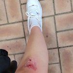[하소연] 다들 <b>버스</b>계단은 조심히 내리자