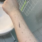 혐주의) 재수생 <b>몇</b> <b>달</b> 만에 때 미는 중