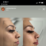 외국애들 메<b>부리</b>코